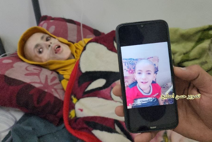 A New Leading Cause of Death in Gaza: Starvation and Lack of Food
