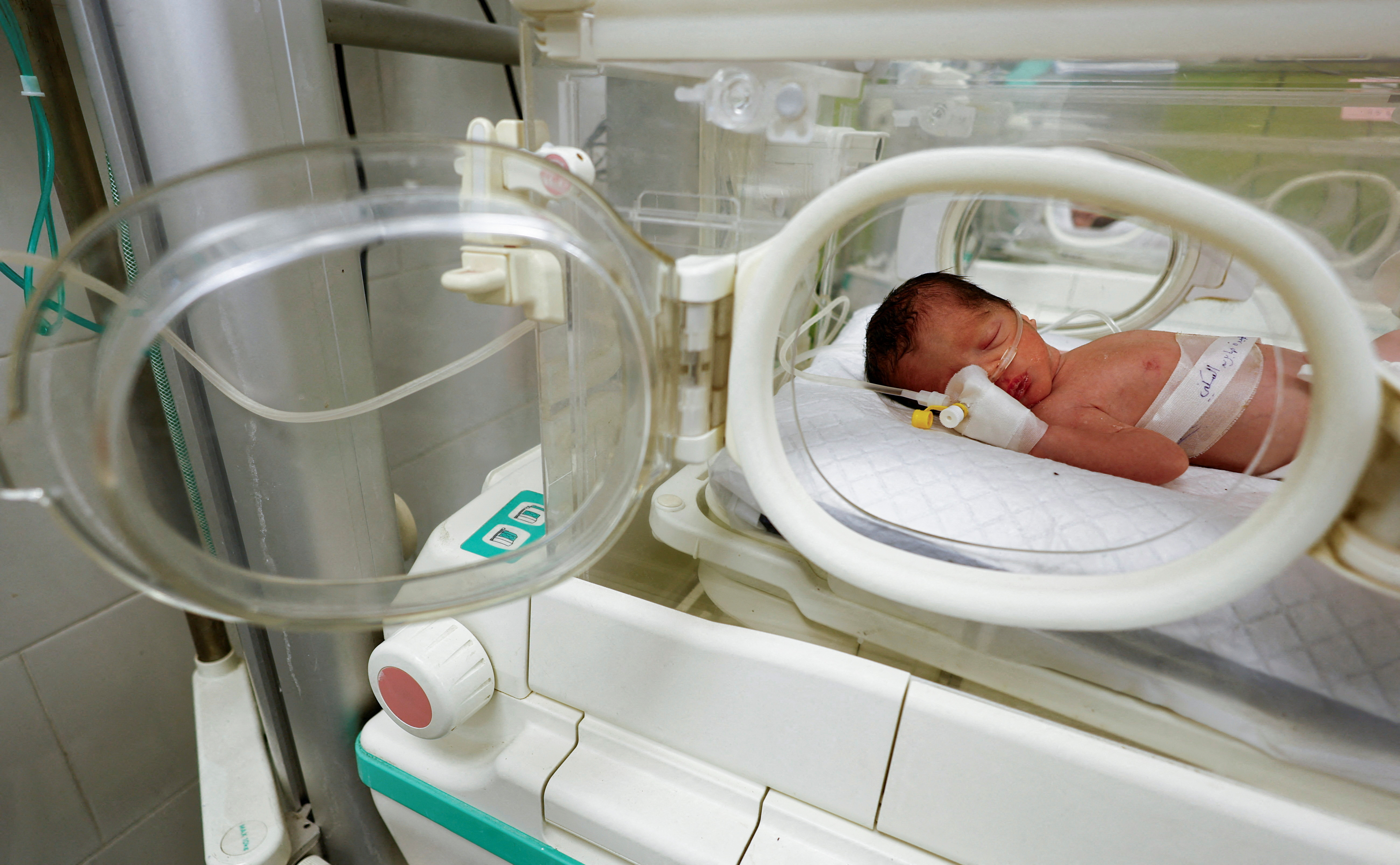 Palestinian baby girl delivered prematurely from womb of her mother, who was killed in Israeli attack on Gaza