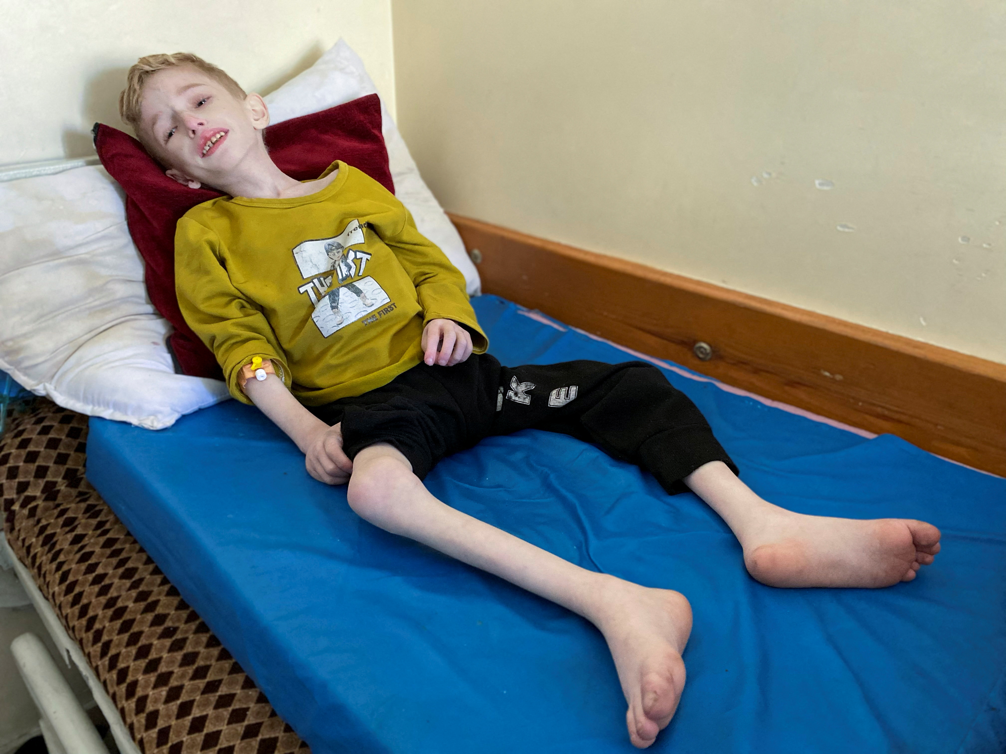 Malnourished Palestinian boy Fadi al-Zant lies on a bed at Kamal Adwan hospital, amid the ongoing conflict between Israel and Hamas, in northern Gaza, March 10, 2024