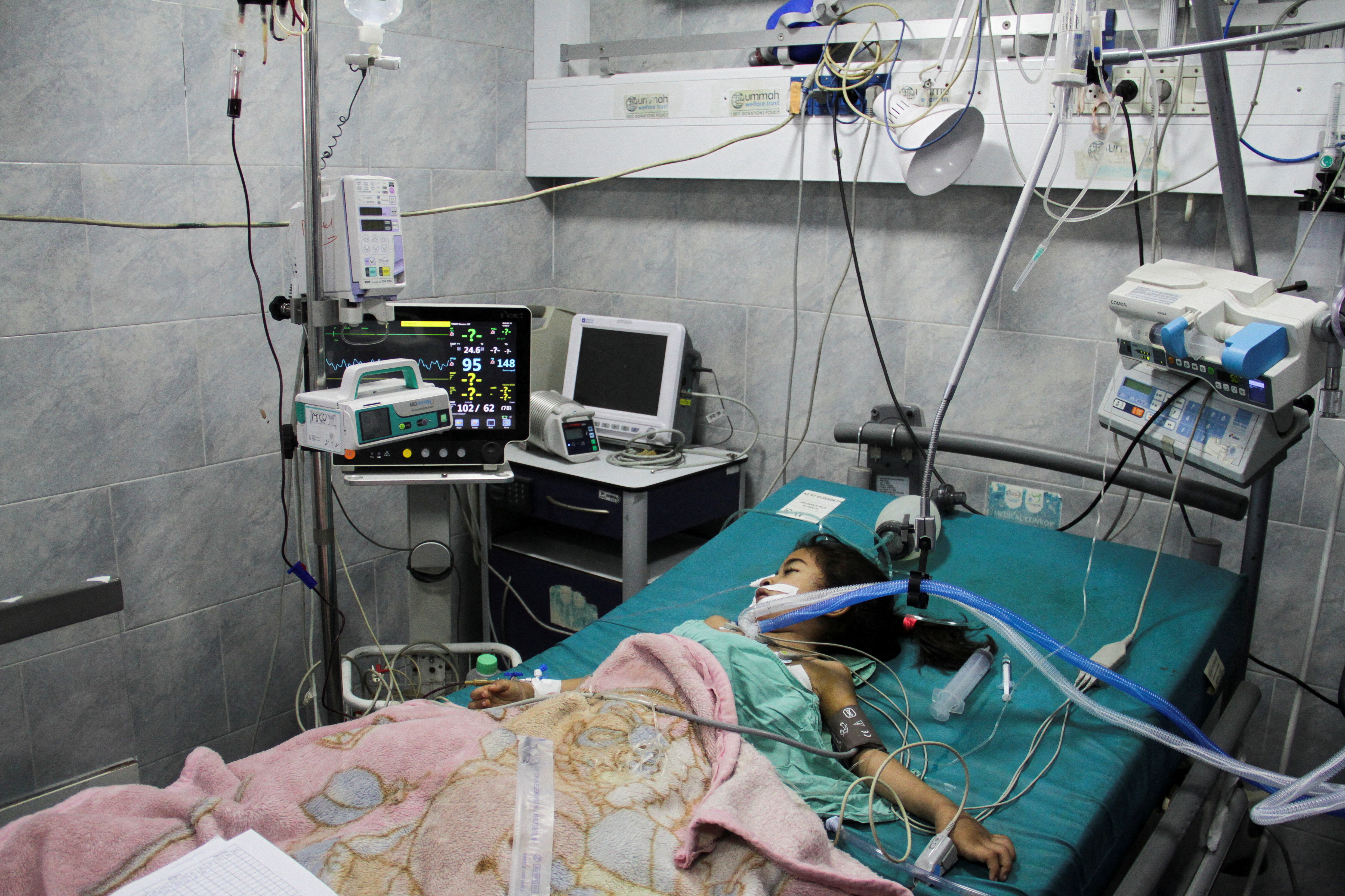 A Palestinian child, who is suffering from malnutrition, receives healthcare at Kamal Adwan Hospital in northern Gaza Strip,